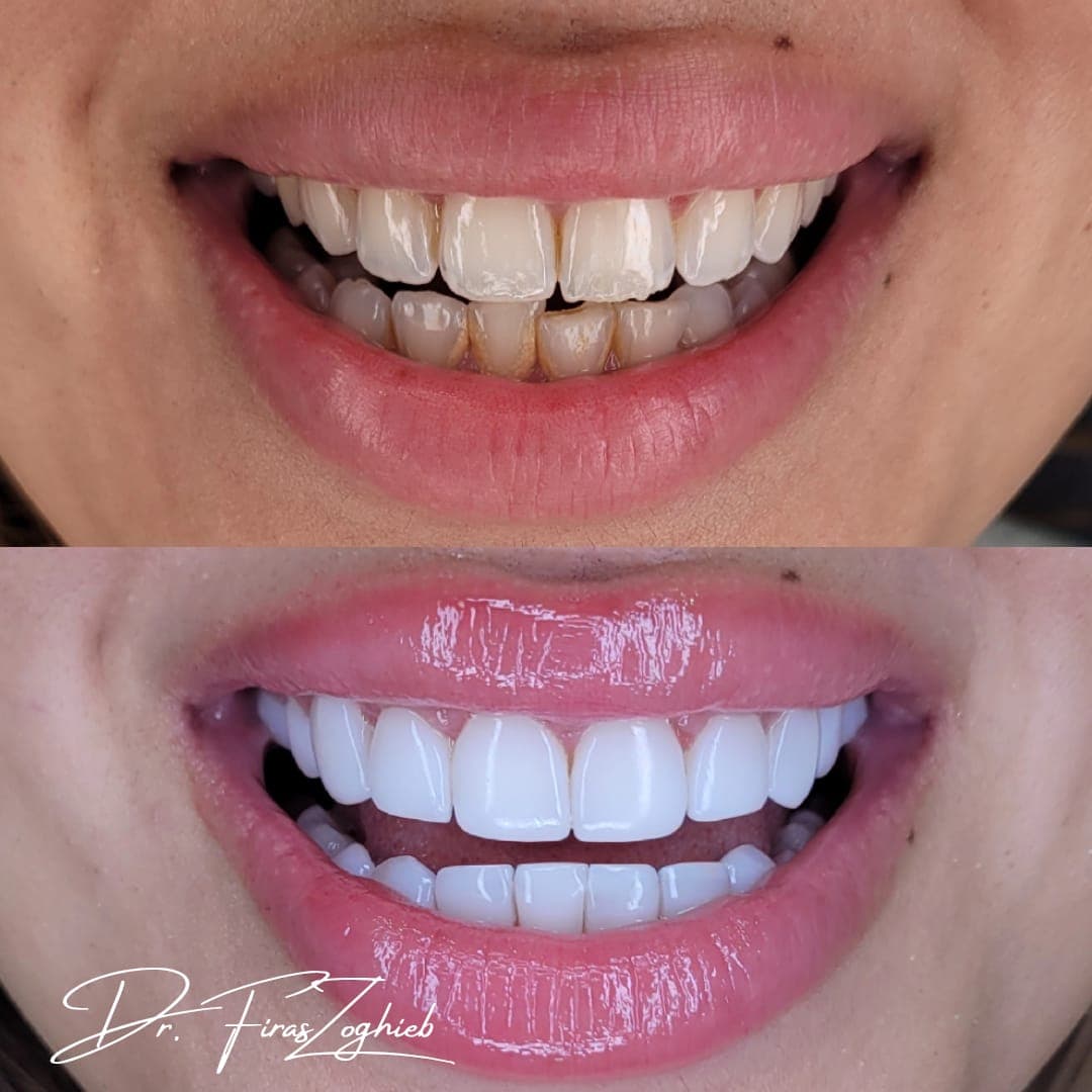 Best Cosmetic Dentistry in Dubai: Treatments, Benefits, and How to Choose the Right Dentist